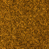 Globuli rossi al microscopio elettronico